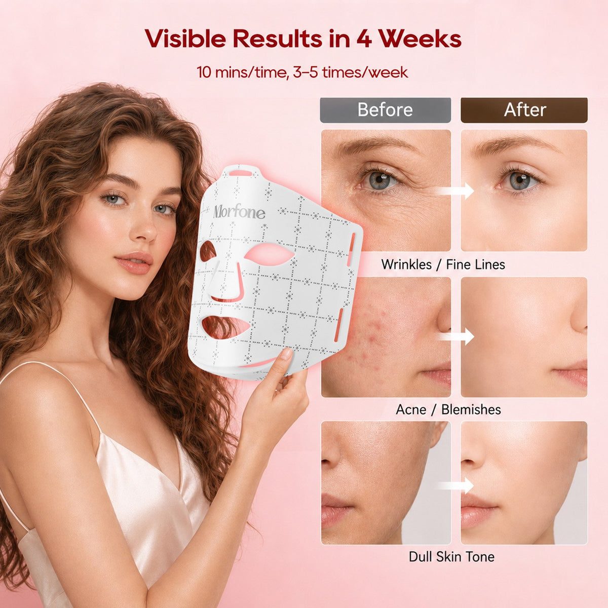 Morfone Red Light Therapy for Face, 7 Modes LED Face Mask, 300 LED Red Light Mask, 630nm & 850nm NIR