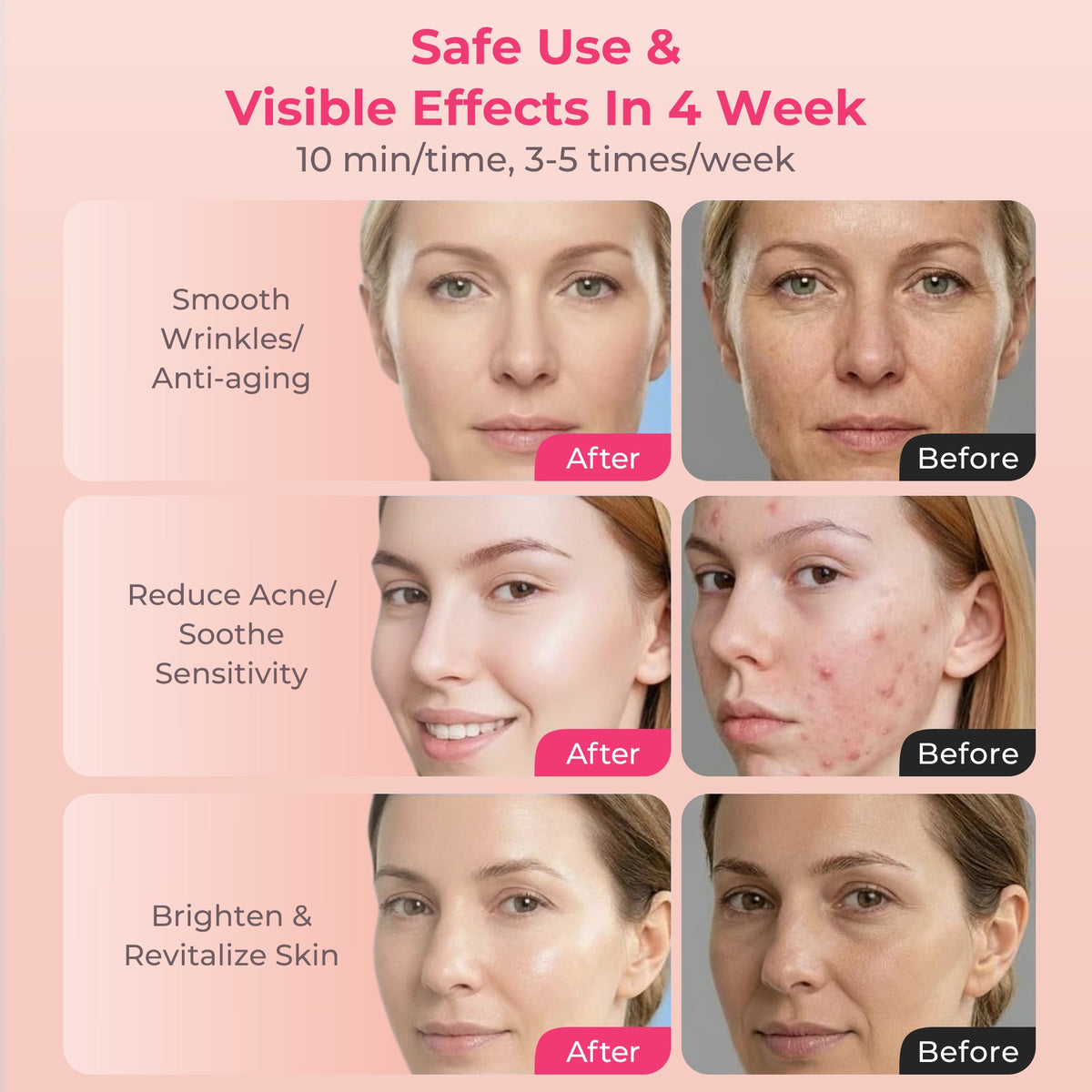 Morfone Red Light Therapy for Face, Wireless LED Face Mask,7 Modes