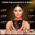 Morfone Red Light Therapy Mask for Face, 4 Modes Led Face Mask, 850NM Infrared & Red Light Mask at Home, Travel (Black)