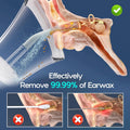Morfone Ear Wax Removal with One-Piece Waste Tank, Ear Cleaner with Water Temperature Sensor, 4 Pressure Settings, Ear Cleaning Kit for Ear Wax Buildup & USB-C Cable, IPX6