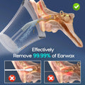 Morfone Ear Wax Removal with One-Piece Waste Tank, Ear Cleaner with Water Temperature Sensor, 4 Pressure Settings, Ear Cleaning Kit for Ear Wax Buildup & USB-C Cable, IPX6