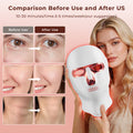 Morfone Red Light Therapy for Face & Neck, 7-in-1LED Face Mask with 850nm & 660nm NIR, Cordless Infrared Lights Masks for Home Working Travel Yoga Sleep