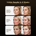 Morfone Red Light Therapy Mask for Face, 4 Modes Led Face Mask, 850NM Infrared & Red Light Mask at Home, Travel (Black)