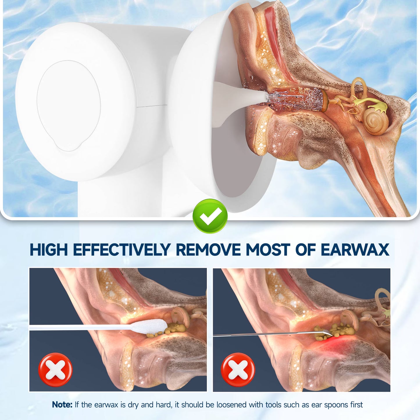 Morfone Upgraded Ear Wax Removal, 2 in 1 Cleaning & Drying Ear Cleaner, Effective Ear Cleaning Kit with One-Piece Waste Tank, Safe Ear Irrigation with 5 Pressure Settings, IPX7 (Black)