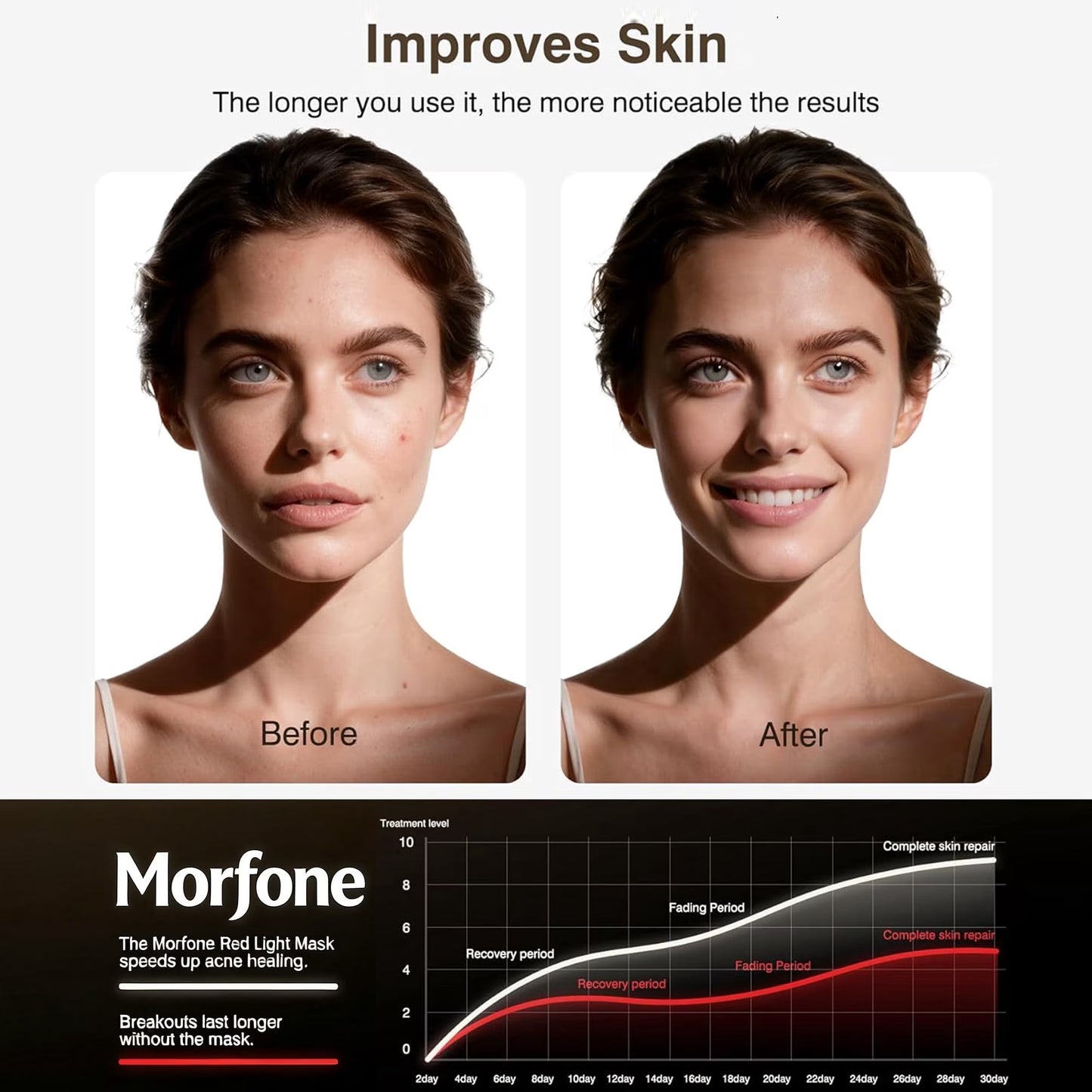 Morfone Red Light Therapy for Face and Neck, 4 Modes Face Mask Light Therapy with Neck Masks, 850nm Infrared & Red Light Mask for At-Home & Travel, Ideal Gift for Woman