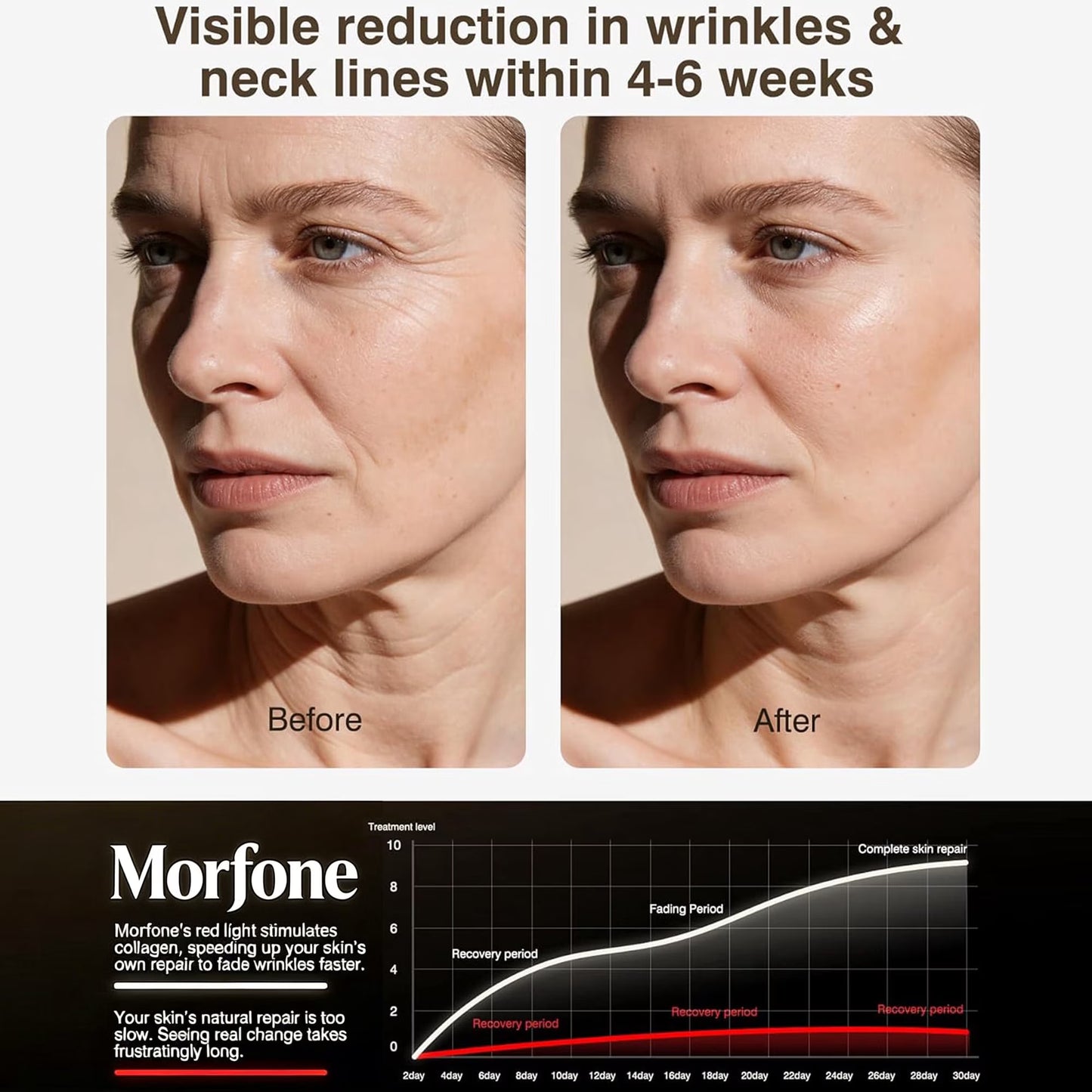 Morfone Red Light Therapy for Face and Neck, 4 Modes Face Mask Light Therapy with Neck Masks, 850nm Infrared & Red Light Mask for At-Home & Travel, Ideal Gift for Woman